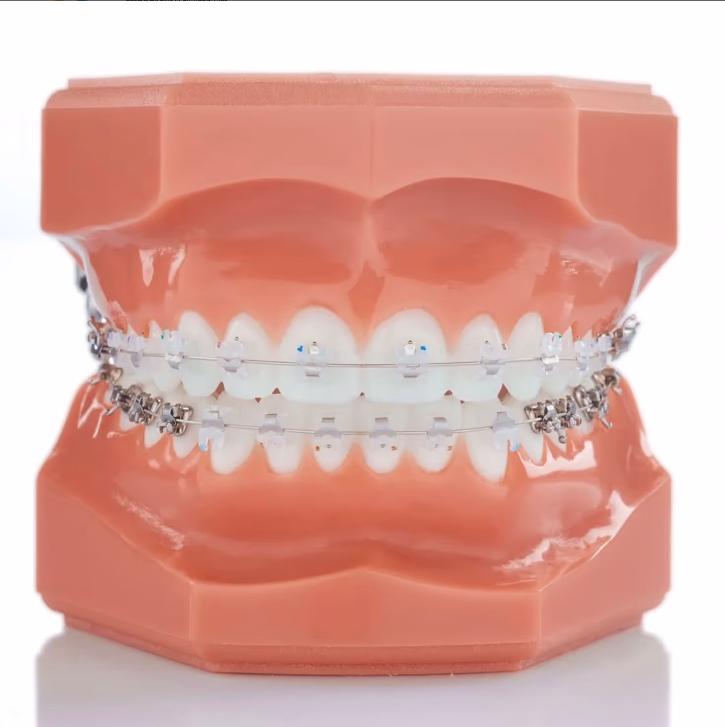 Teenager with Clear Braces smiling