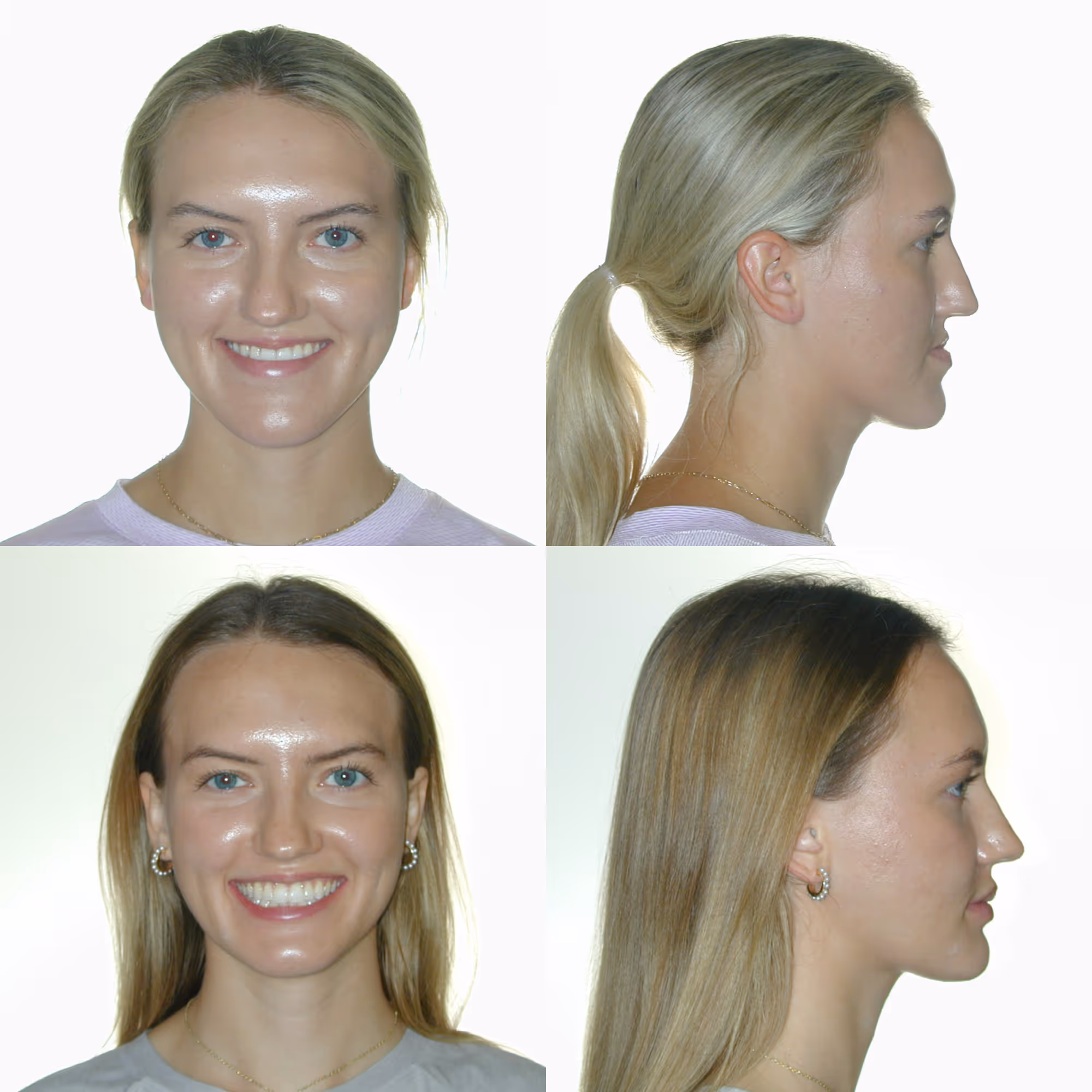 Male patient smiling