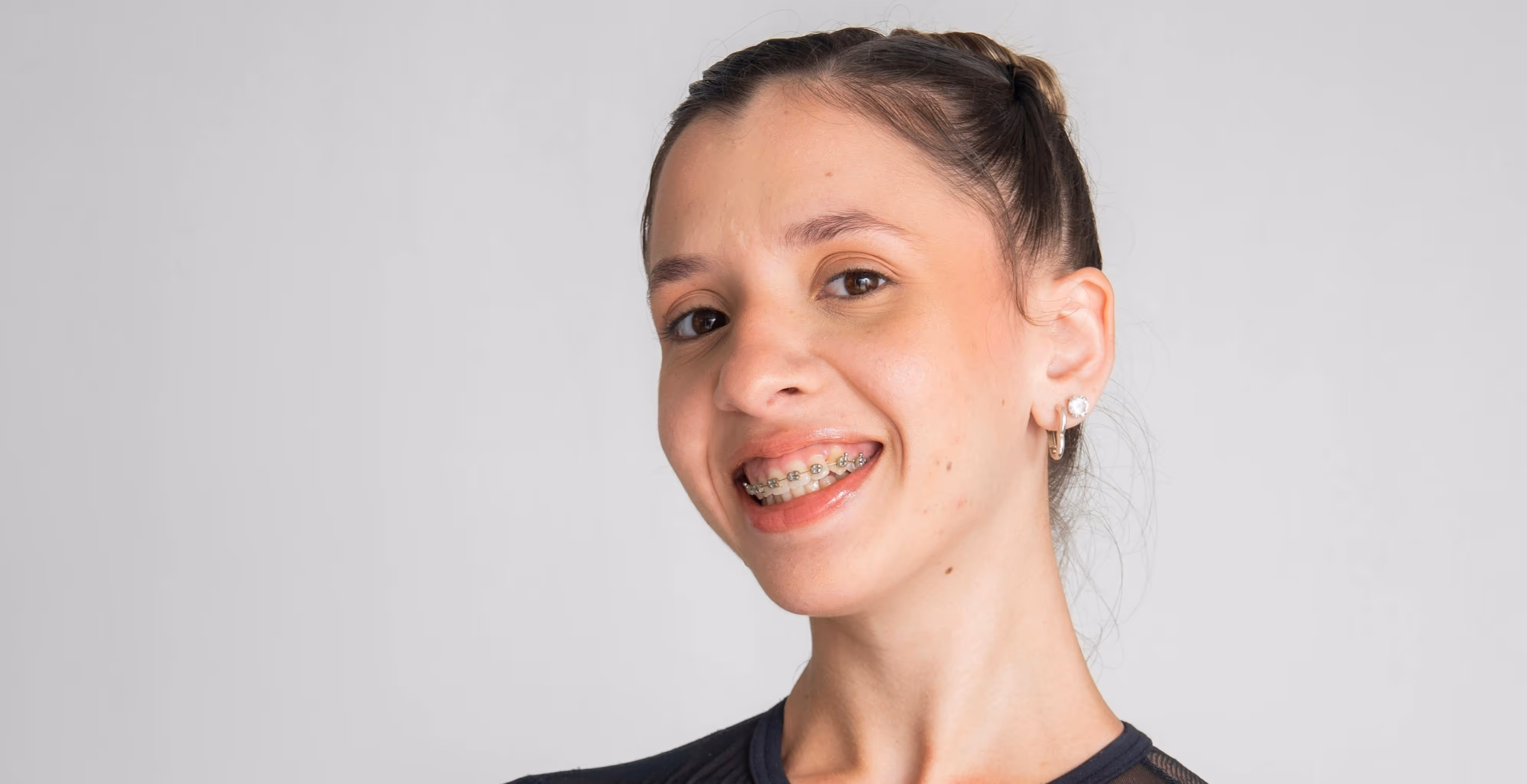Teenager with braces smiling